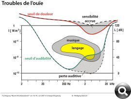 troubles de l’ouïe